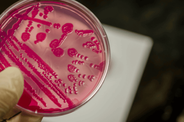 Leer: 10 claves veraniegas, y no tan veraniegas, para prevenir la salmonella.