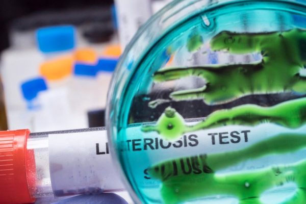 Read: Listeria: el bacteri que posa en perill la seguretat alimentària?